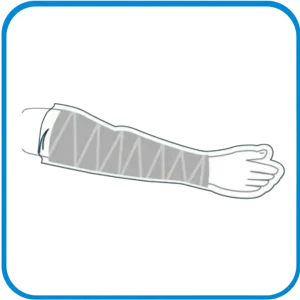 Aquaprotect Braccio Intero